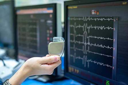 智能手机手表会干扰心脏起搏器